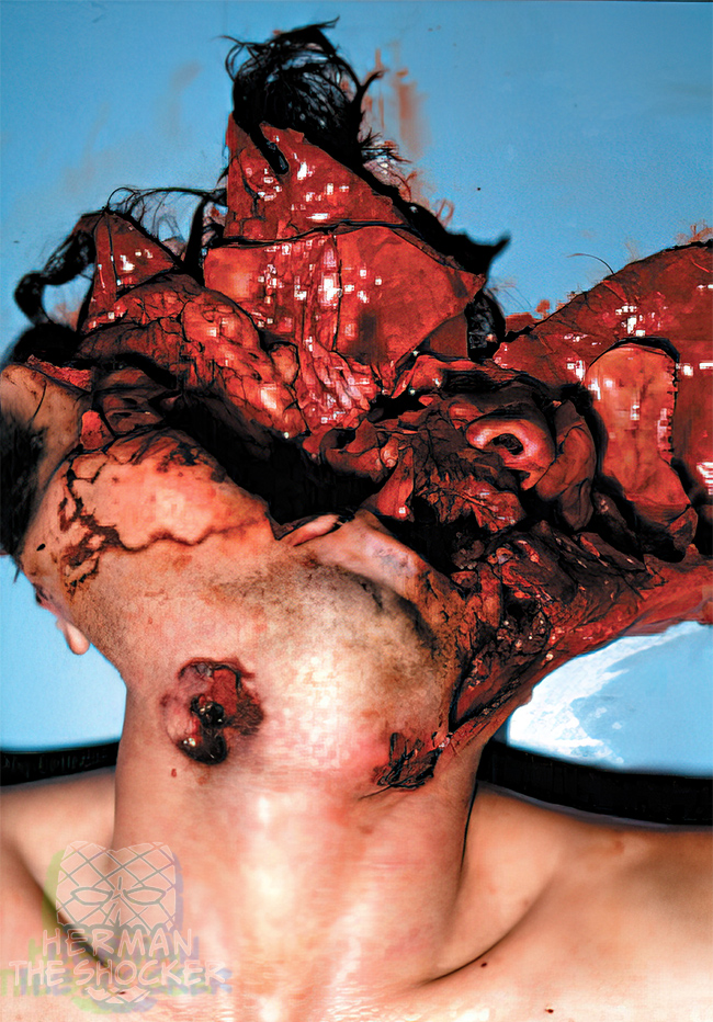Massive explosive burstlike exit wound to the head from a .30-06 hunting rifle