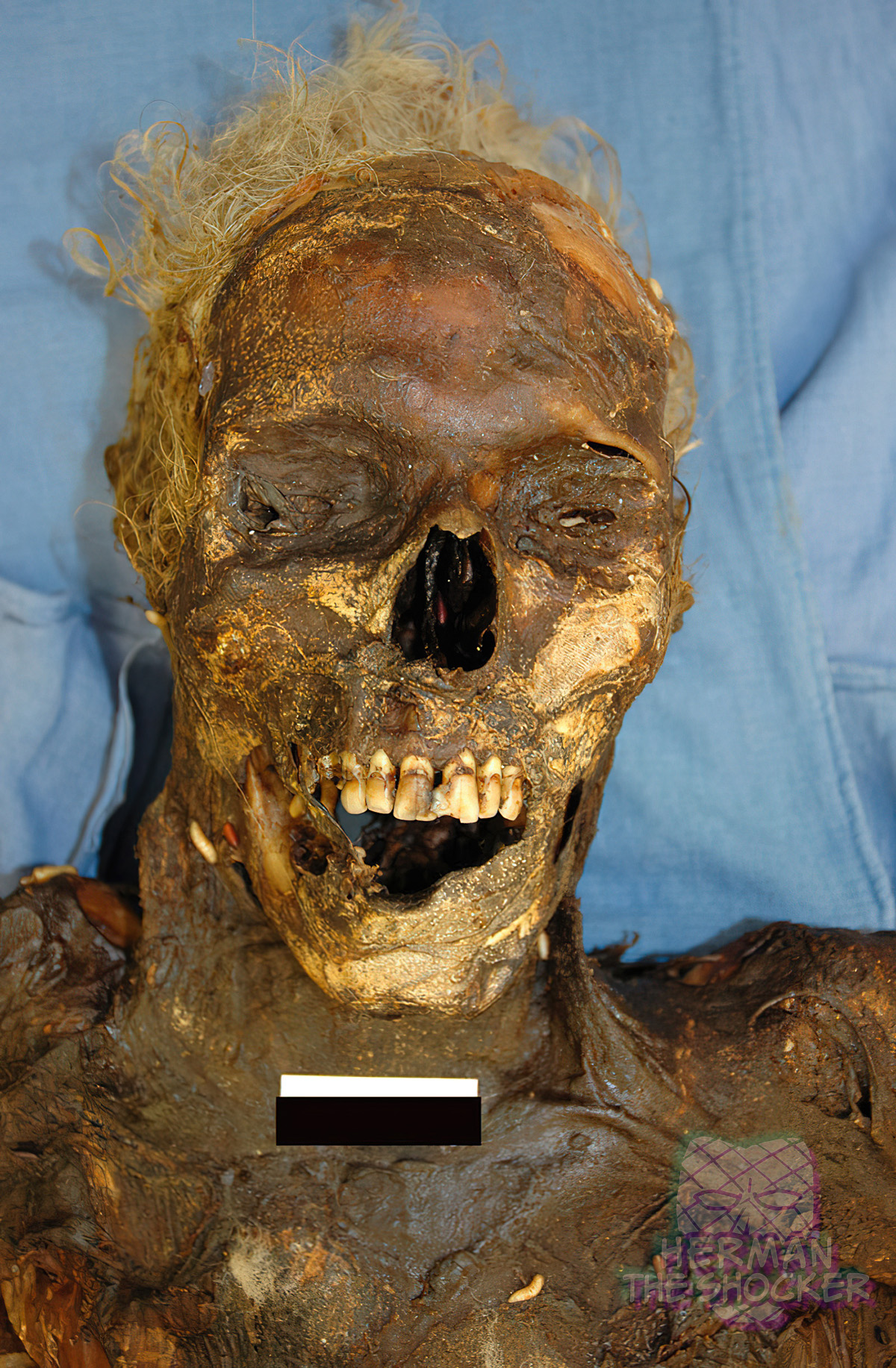 Mummification can result in very hard, leathery skin