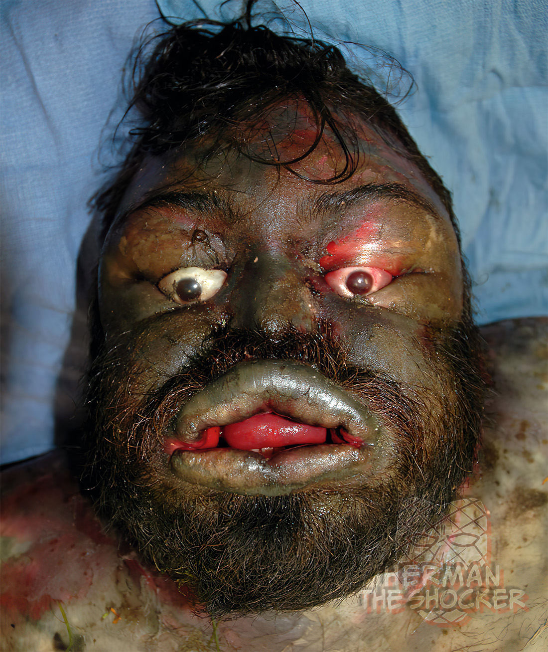 Bulging of the eyes, lips and face, with protrusion of the tongue, all related to decomposition