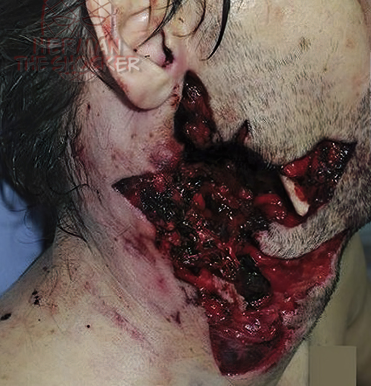 Death from a gunshot wound to the neck