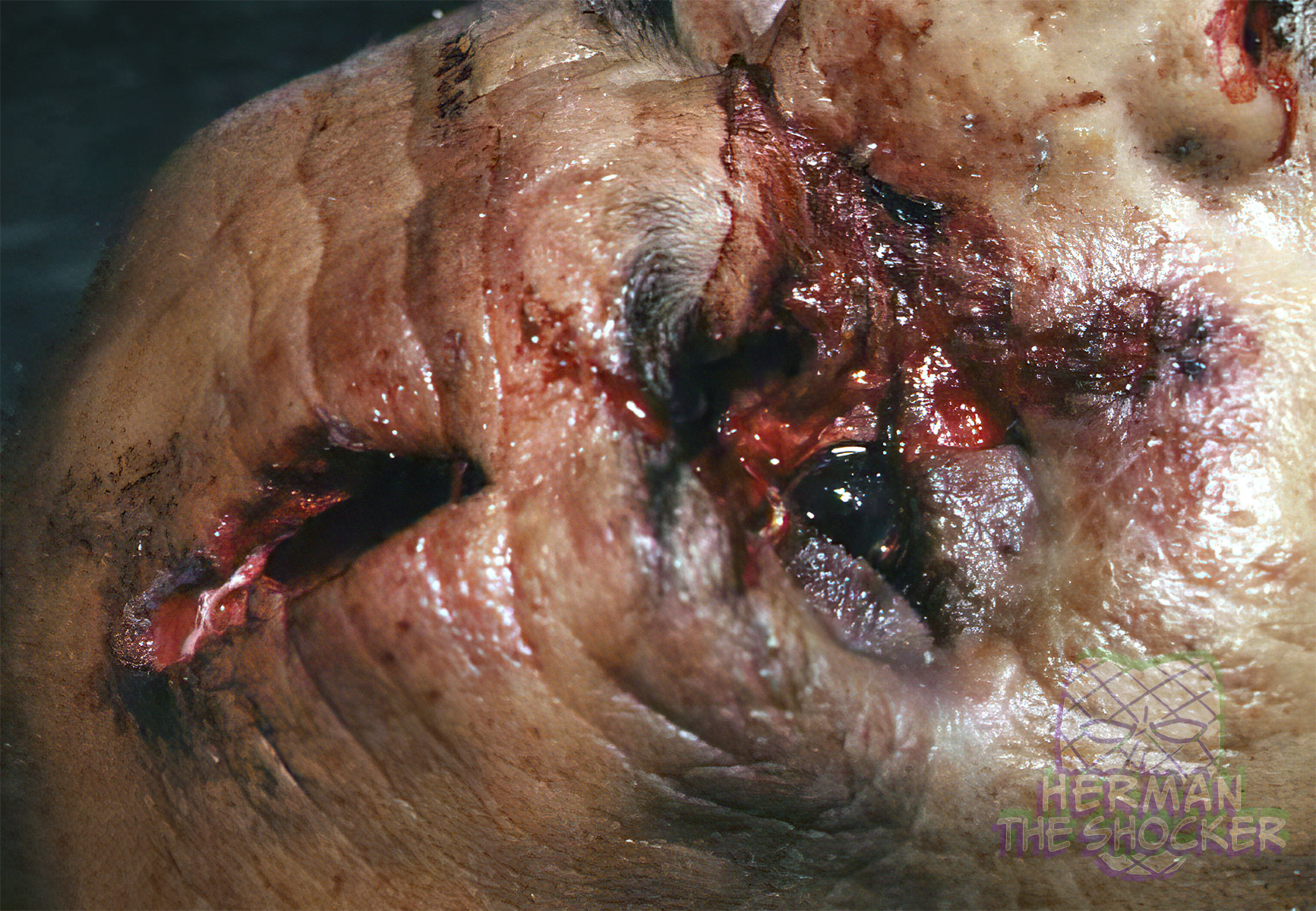 Typical stellate shaped entry wound showing tattooing effect