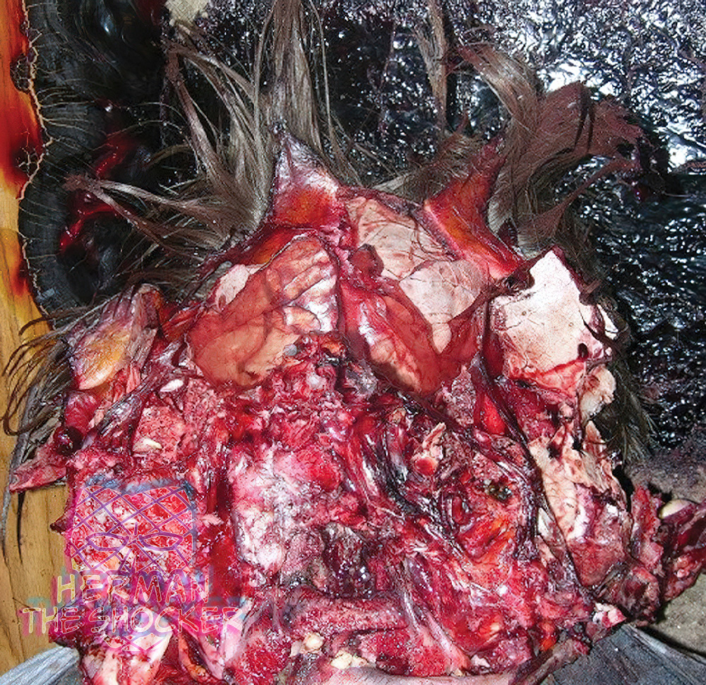 Contact rifle wound of the head