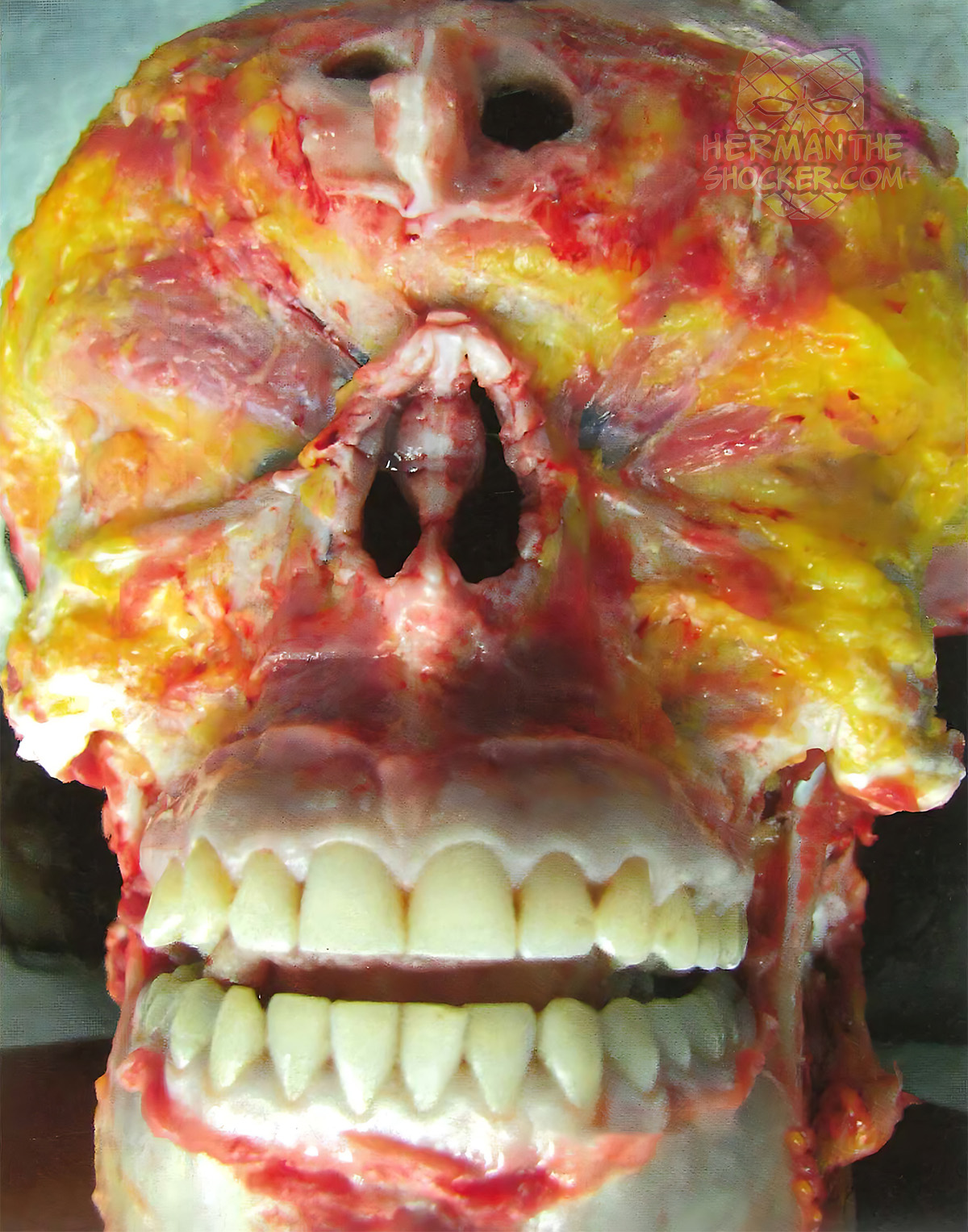 Facial dissection
