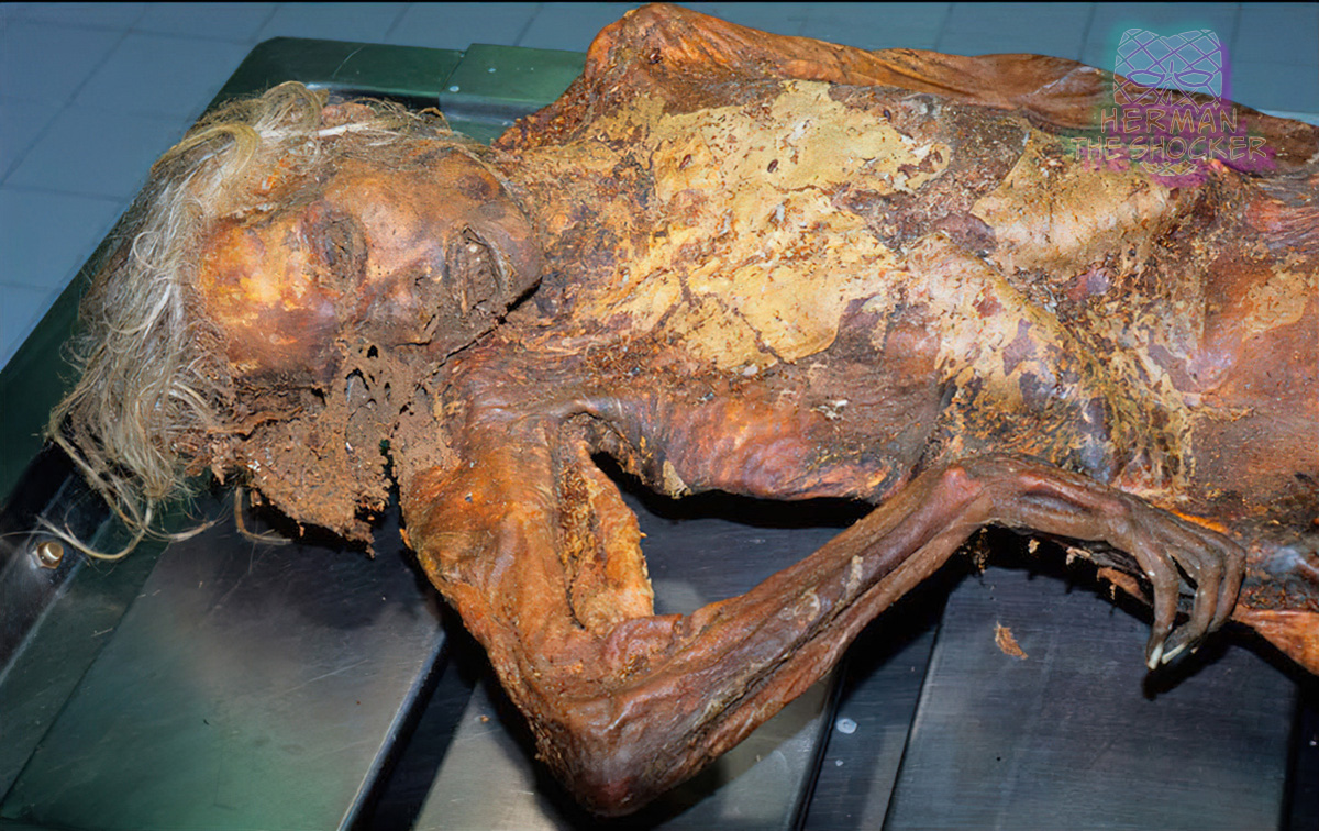 Mummified body of a woman