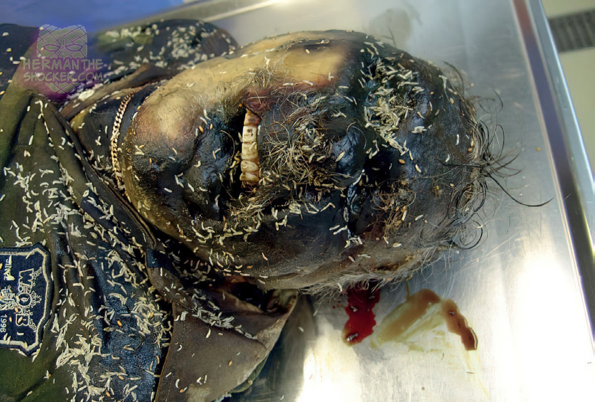 Maggot infestation on putrefying body