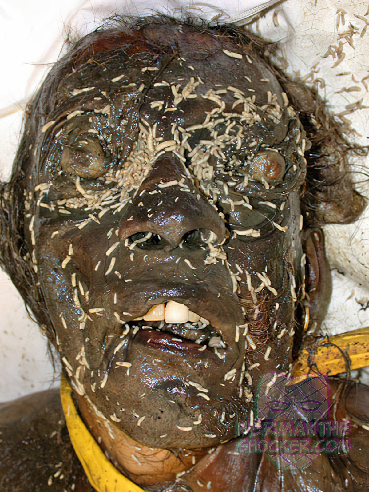 Advanced putrefaction and extensive maggot colonization