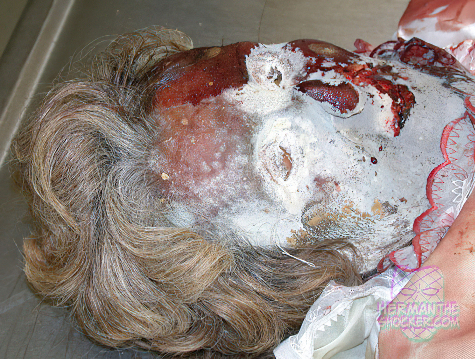 Extensive whitish-gray fungal colonization on corpse’s face