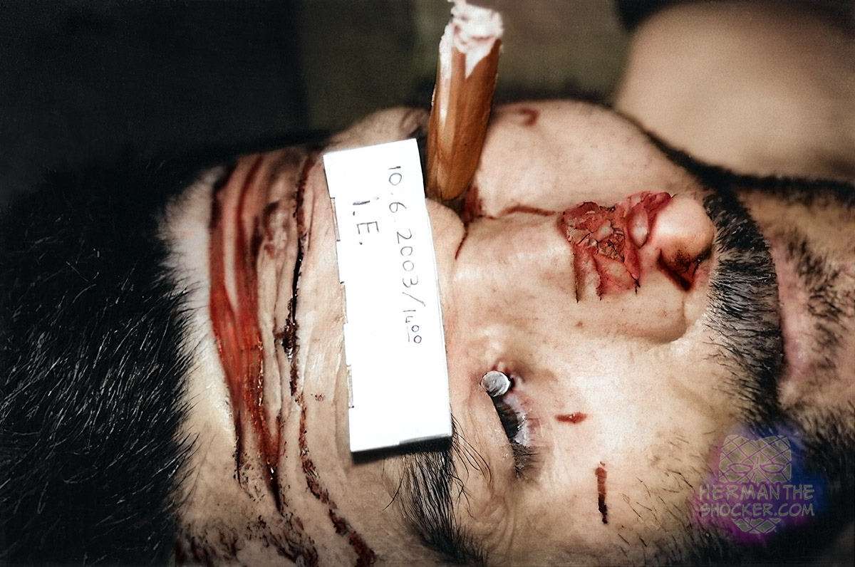 Inmate stabbed by cellmate in the eyes with a piece of wood
