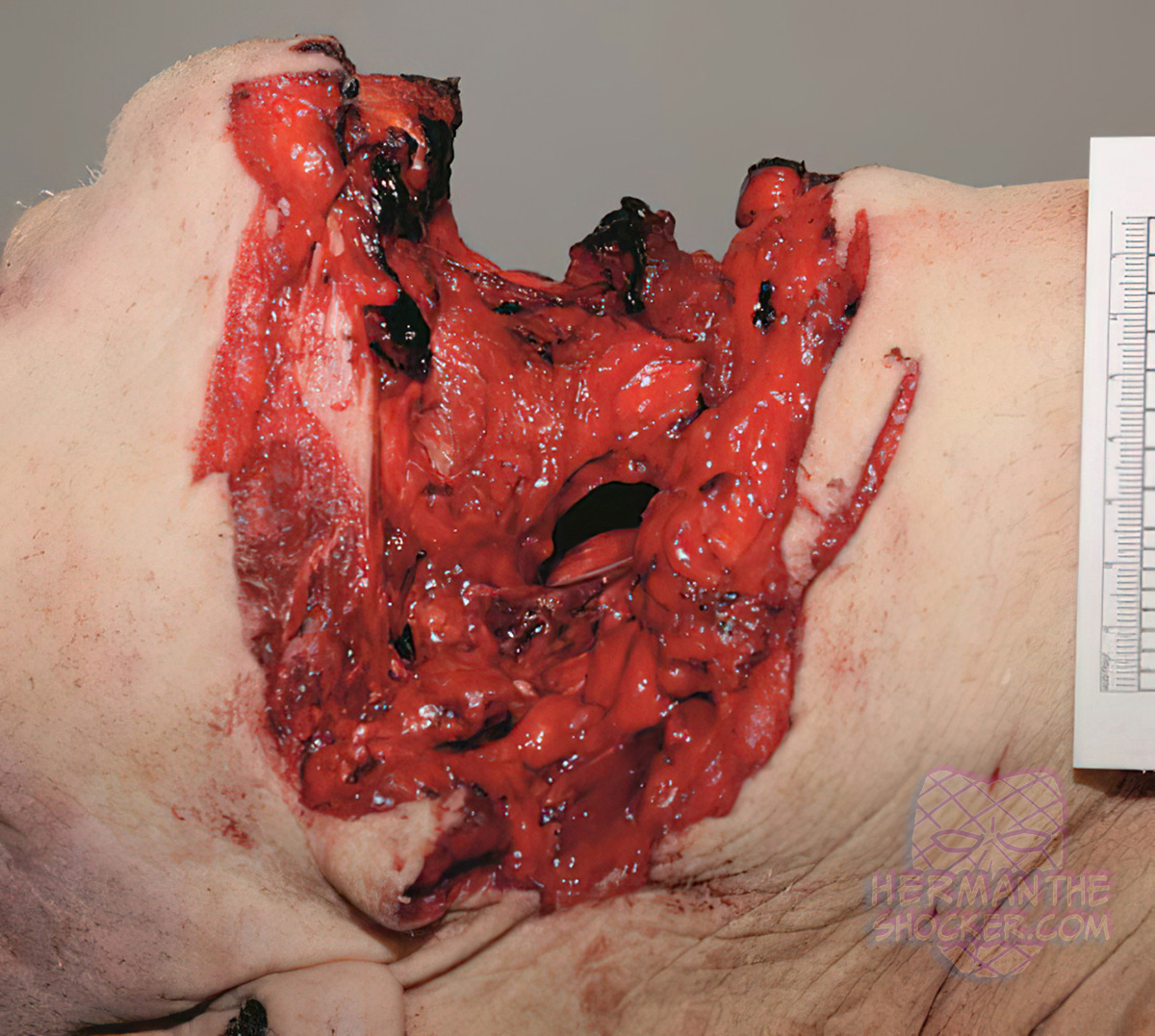Circular saw cuts of the neck