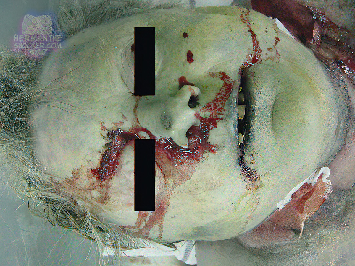 Purging of putrefactive fluid from mouth and nostrils