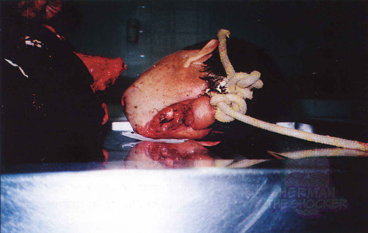 A suicide that resulted in decapitation