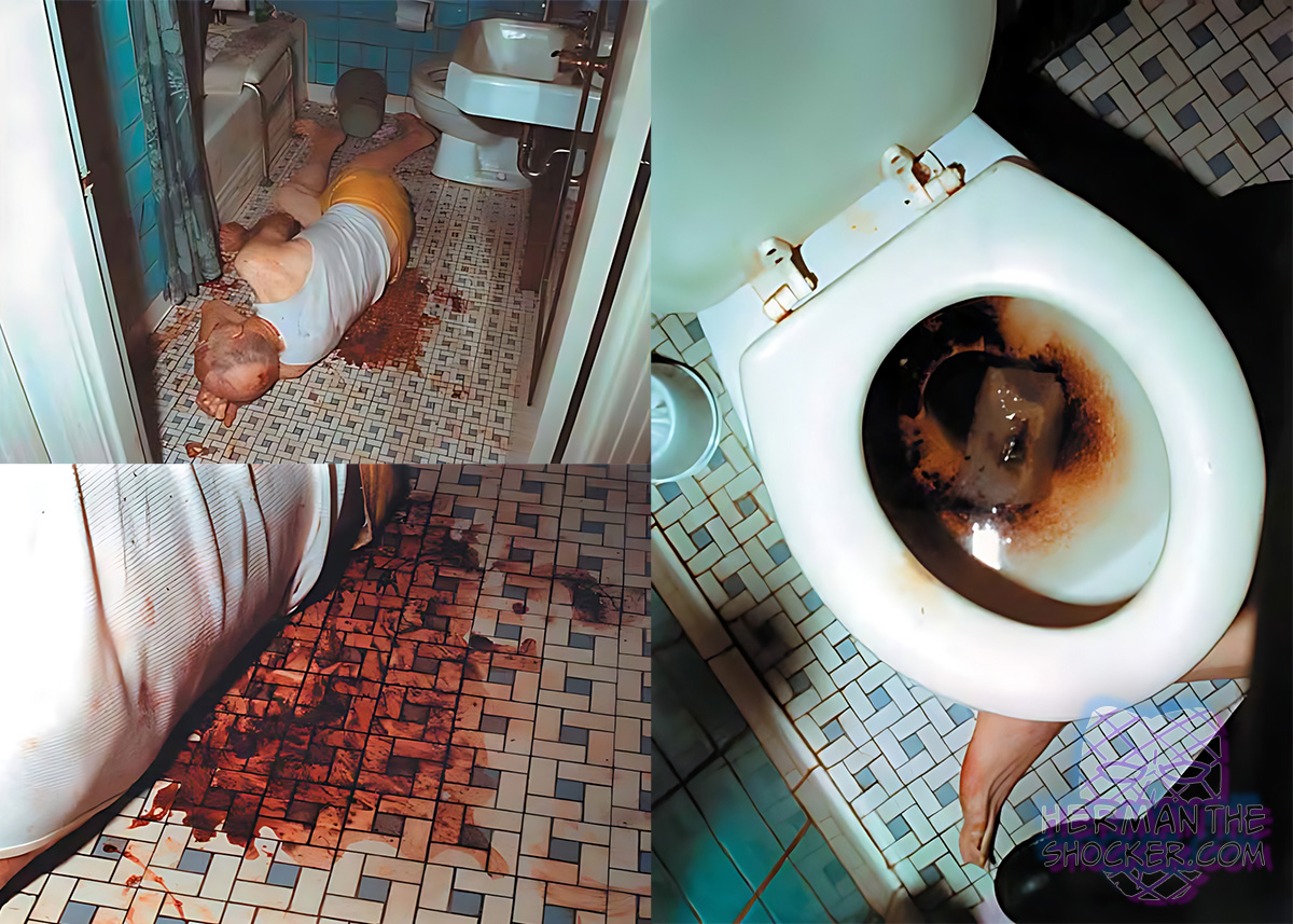 Victim of hemorrhaging peptic ulcer