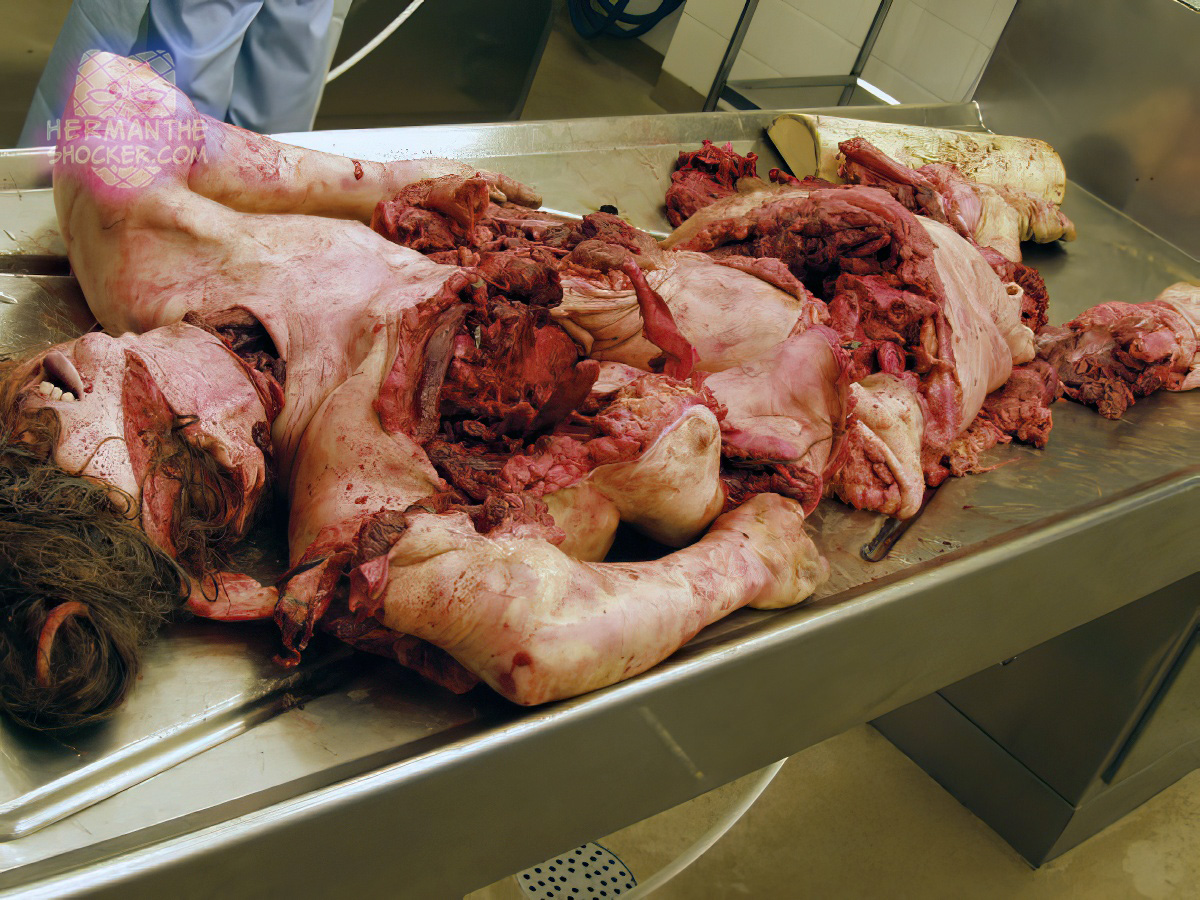 Extensive disintegration of a body that has been run over by a train