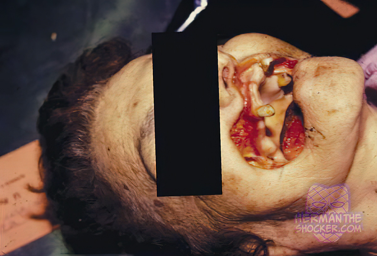 Postmortem injuries made by rodents