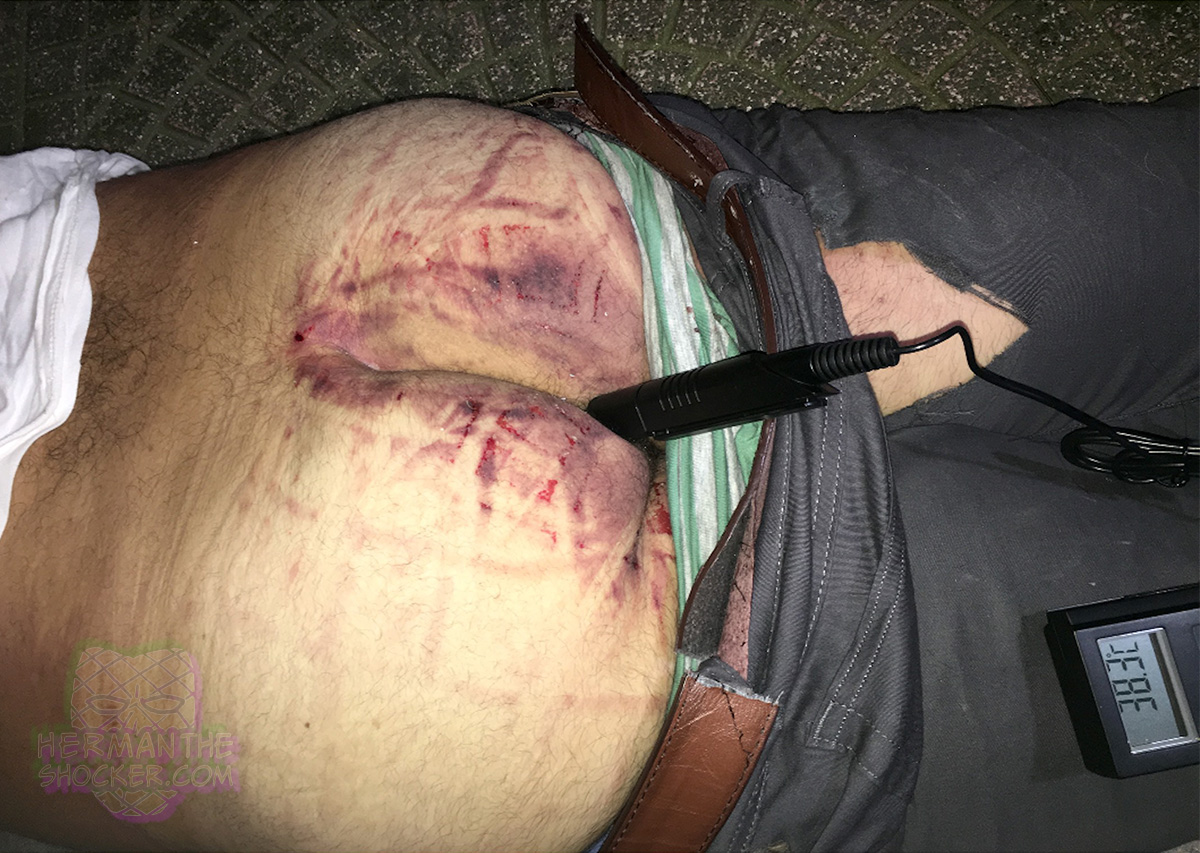 Patterned abraded contusion