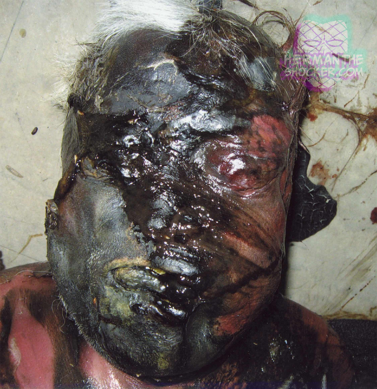 Putrified body of a missing man