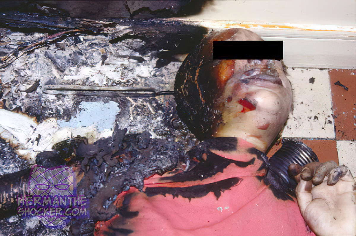 Accidental death by fire