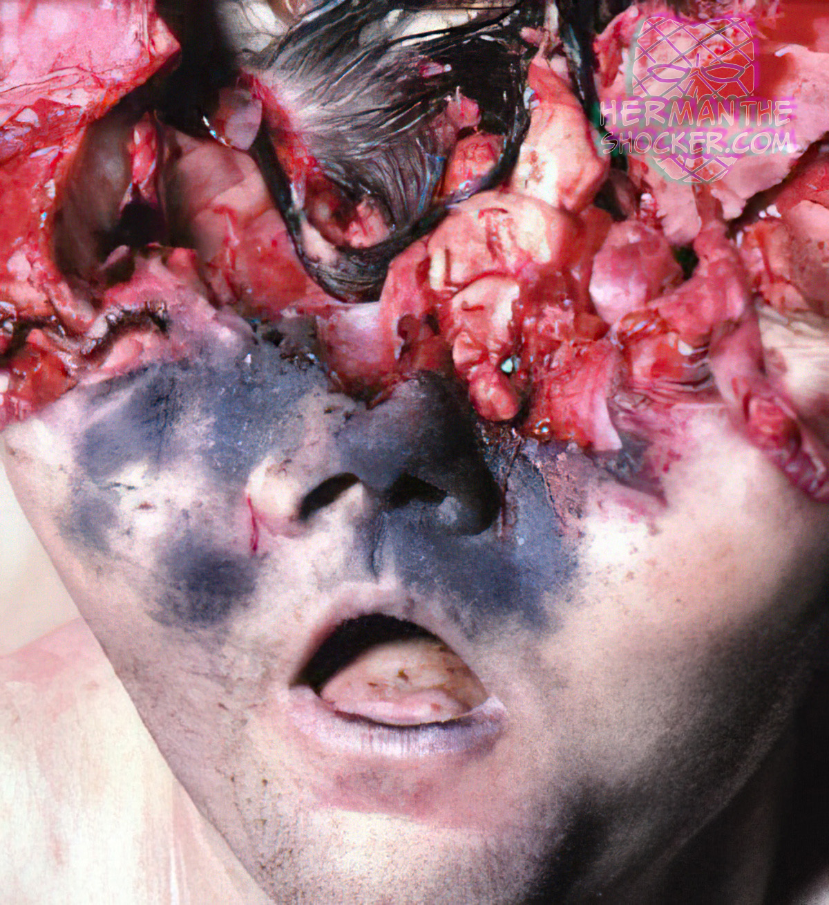 Entrance wound between eyes