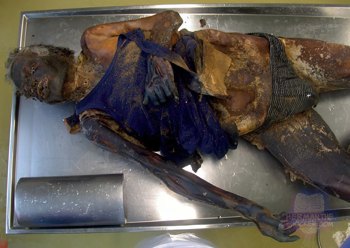 Body in a state of mummification