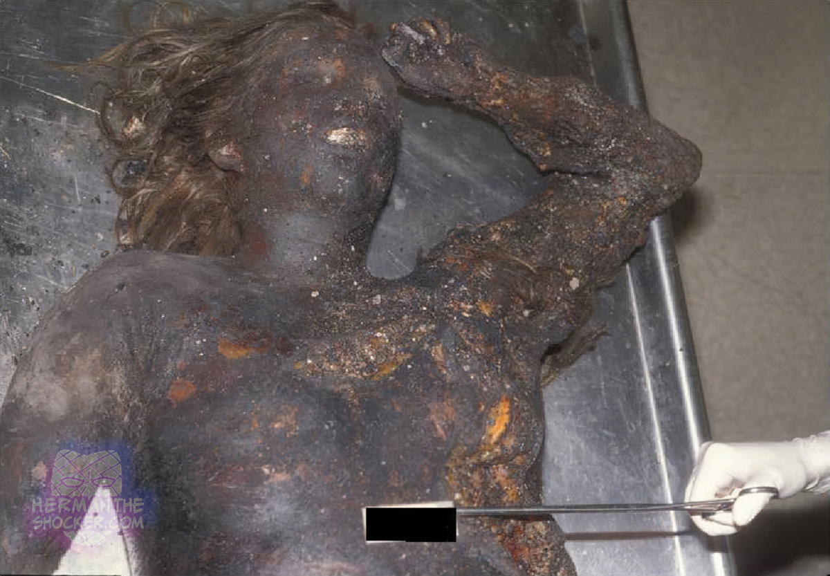 Burned body of a young woman