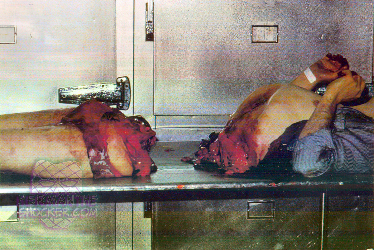 Cross section of the body from a train suicide