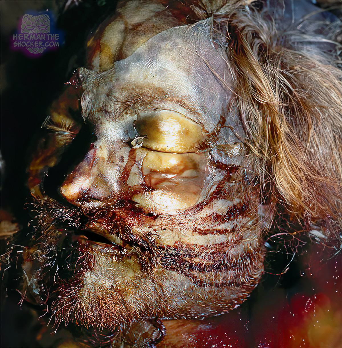 Putrefaction with purge fluid forced out of the nose and mouth