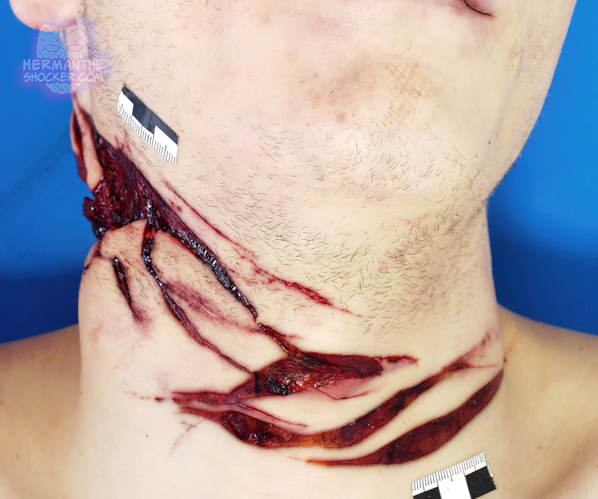 Man cuts his own neck