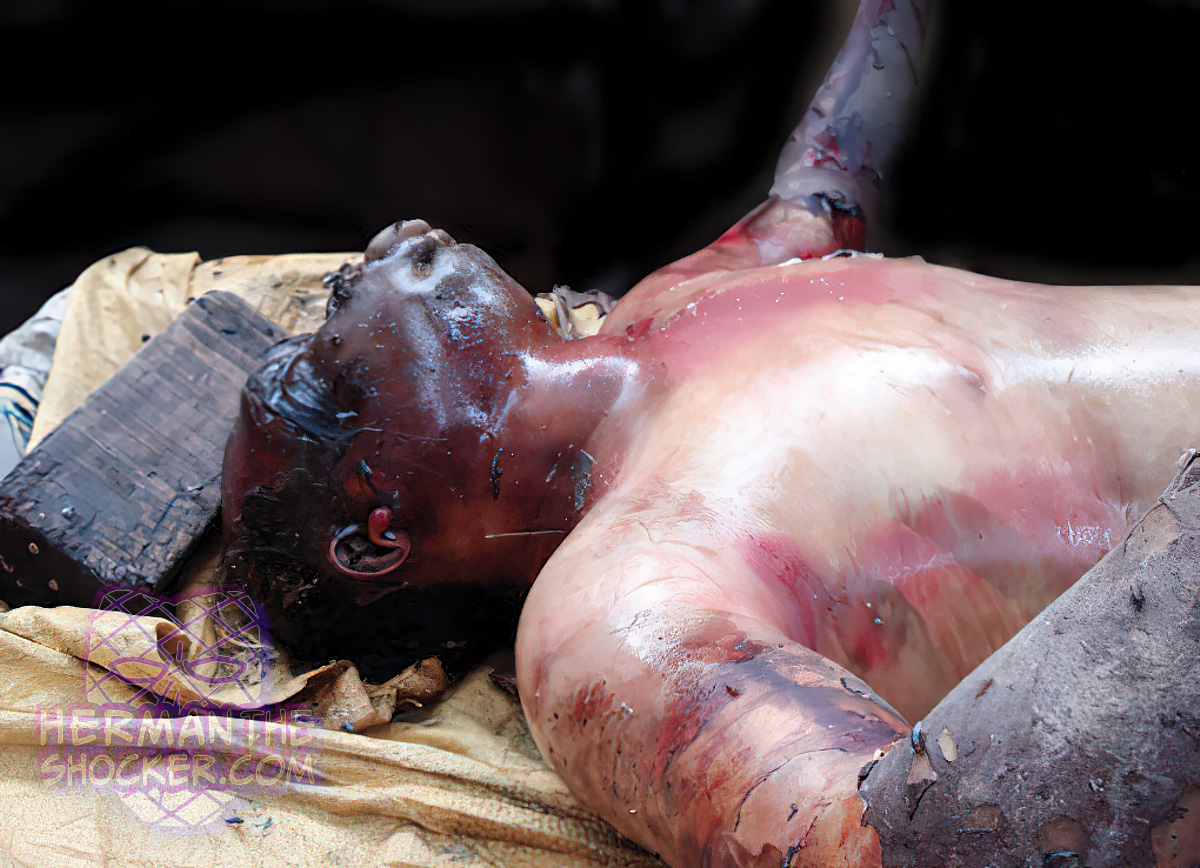 Postmortem bloating of a body