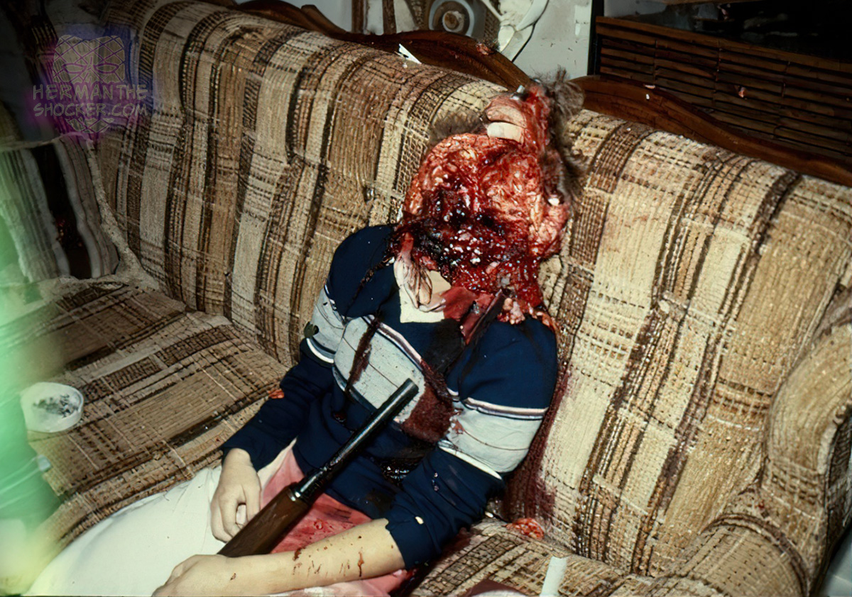 Suicide with a shotgun to the head