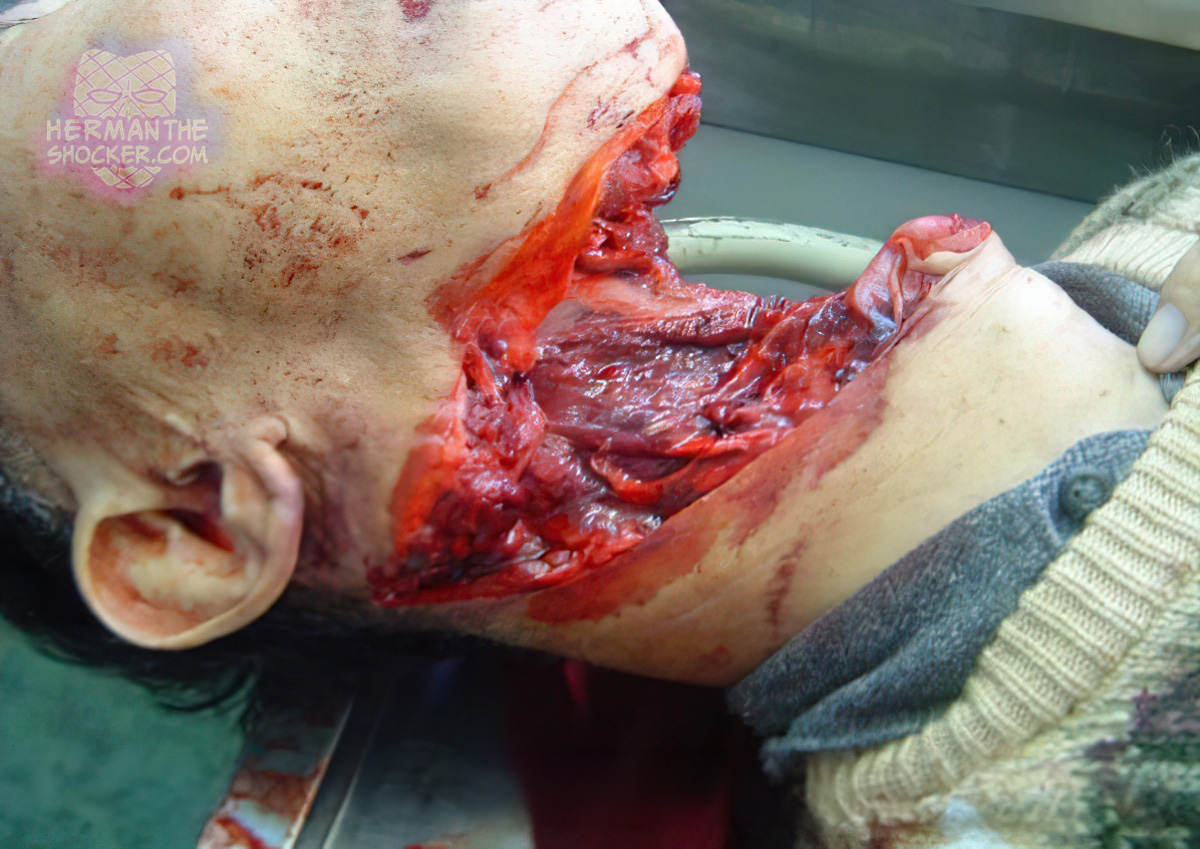 Man nearly decapitated