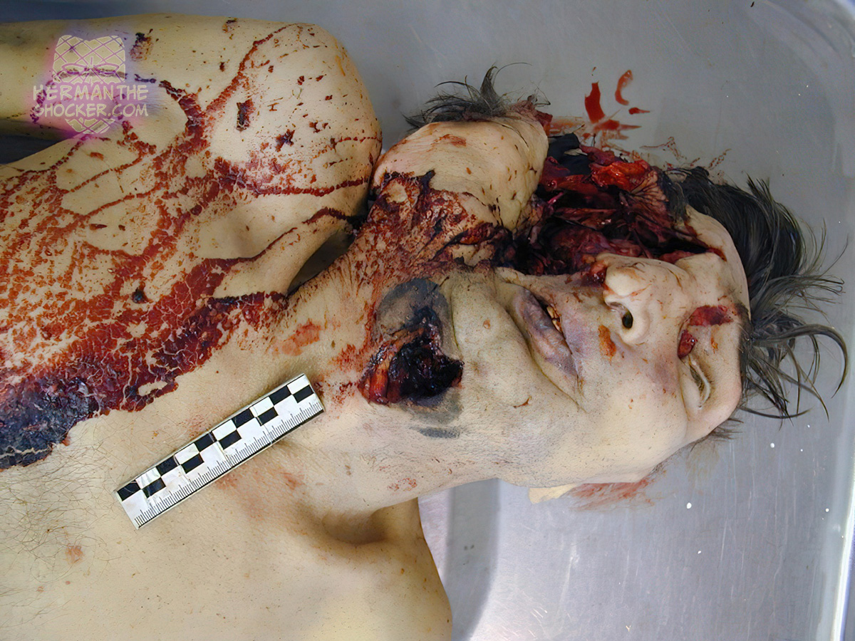 Under the chin gunshot suicide