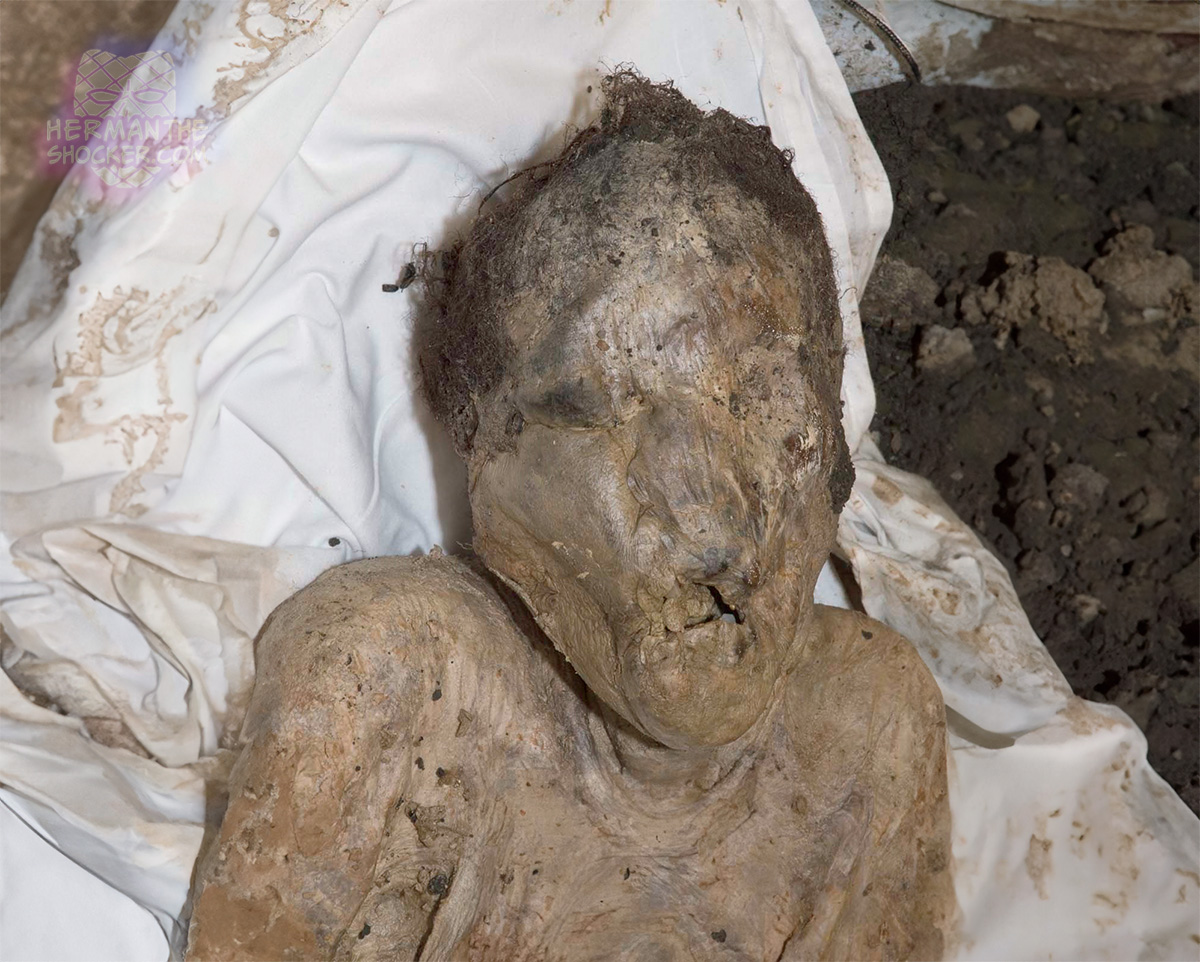 Adipocere formation in remains recovered from a moist environment