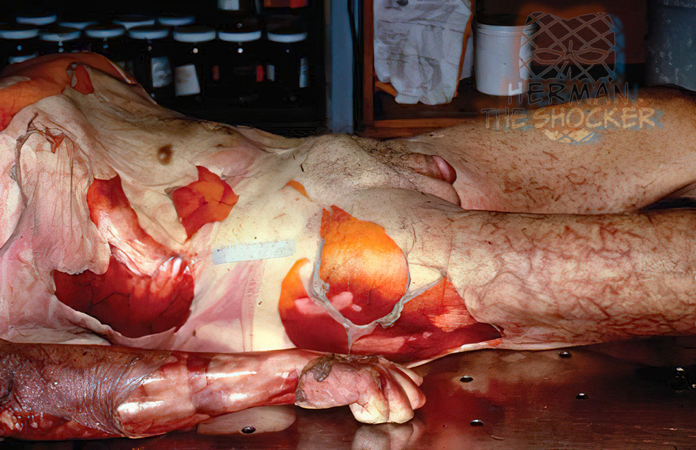 Marbling and skin slippage