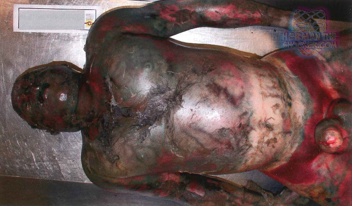 Decomposing body