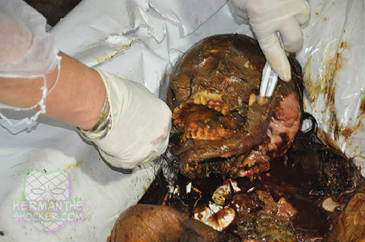 Forensic dental identification