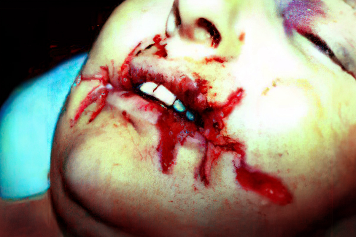 Firearm discharged into the mouth