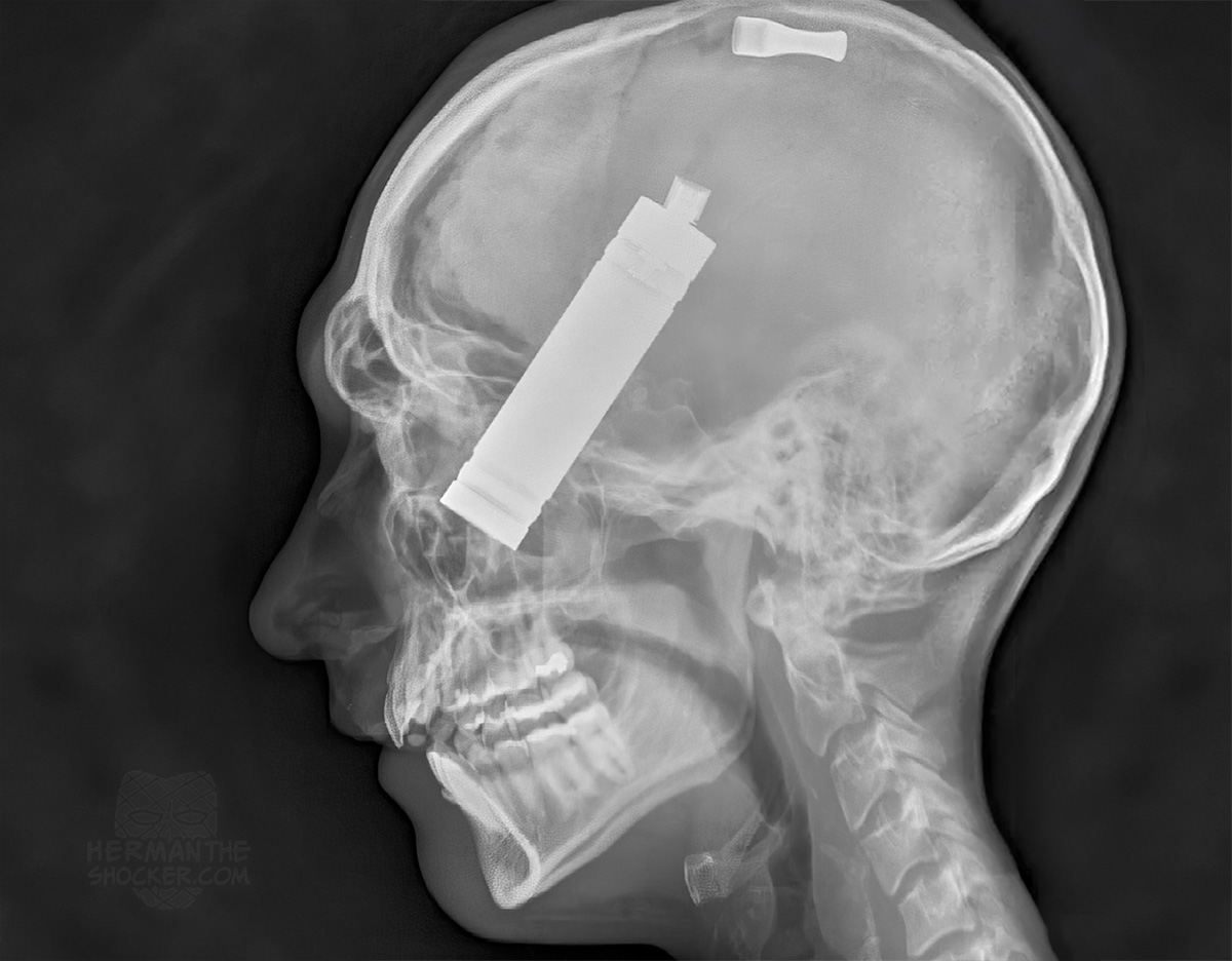 Florida man killed by exploding mech mod vape