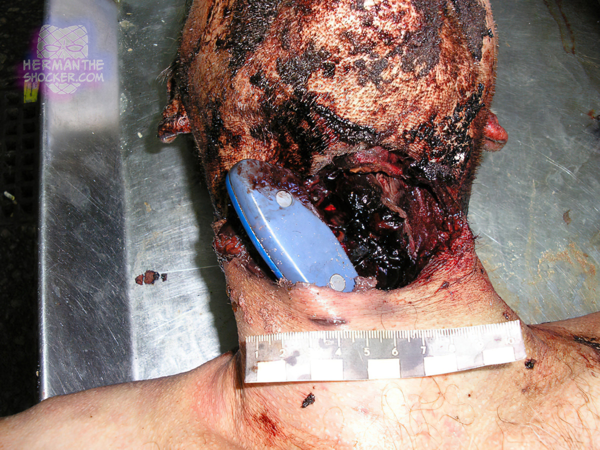 A man cuts his own neck
