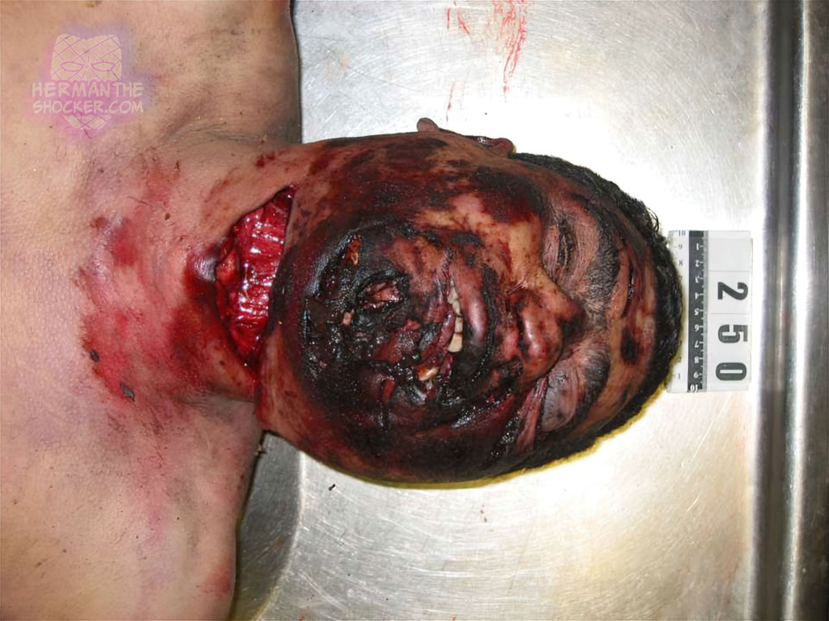 Man beaten up and his throat cut