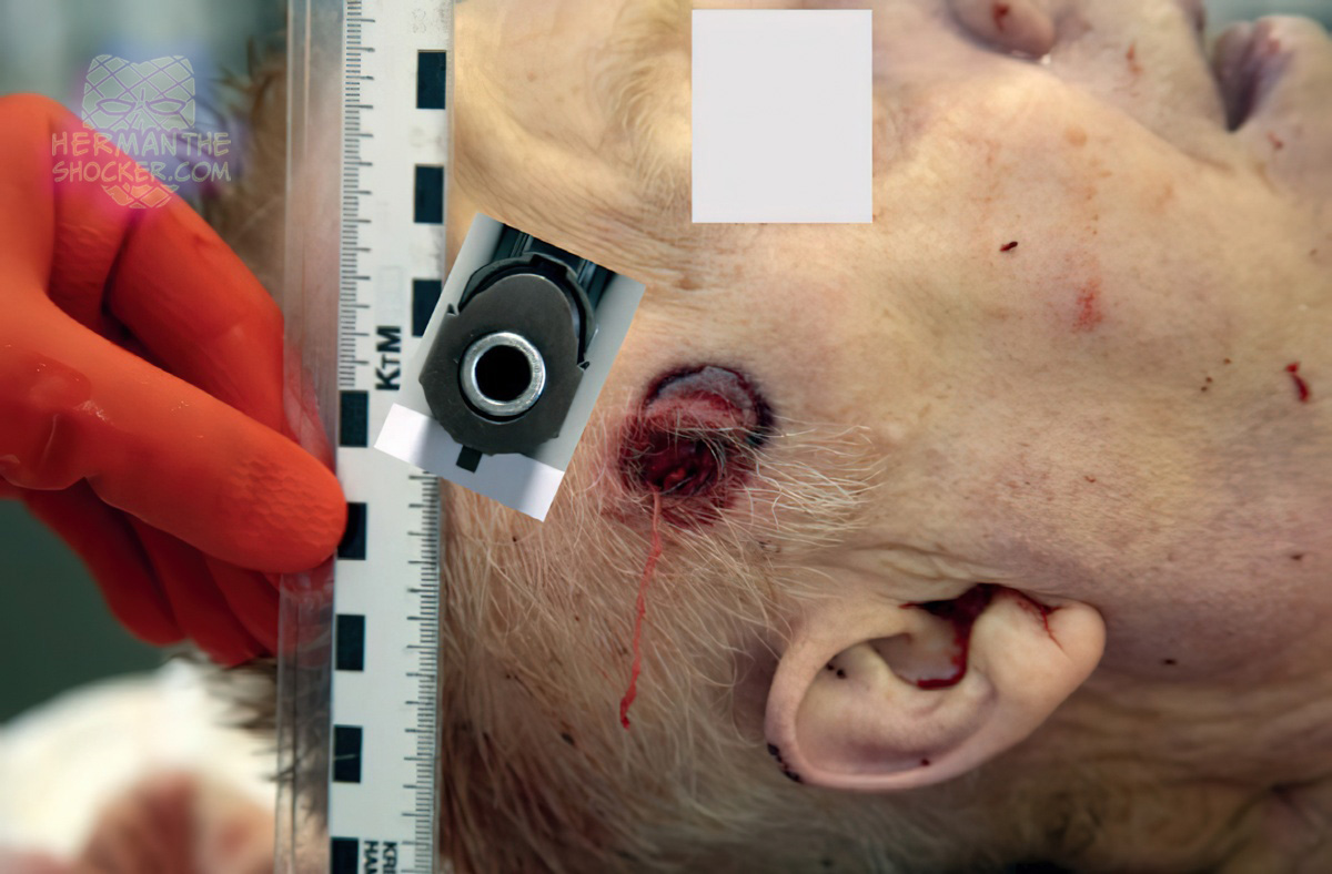 Gunshot wound in the right temple