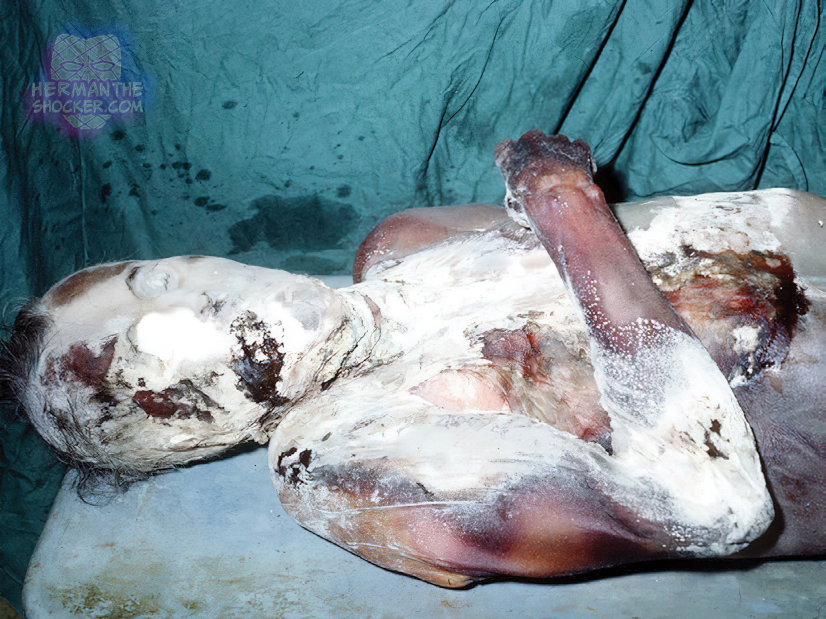The mummified body of an absconder