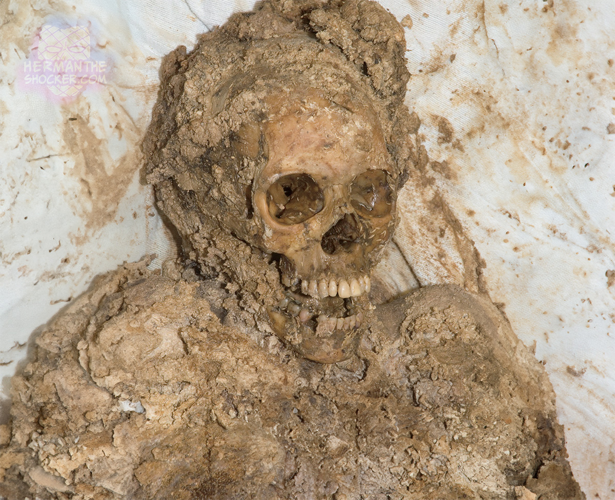 Adipocere formation in remains recovered from a moist environment