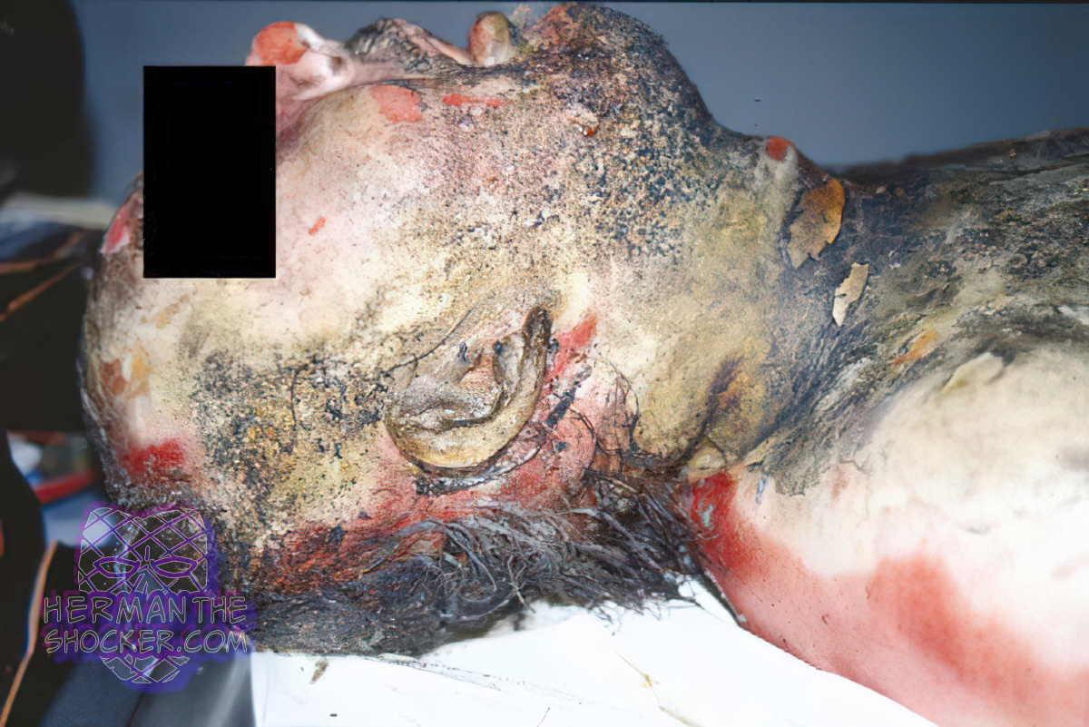 A homeless alcoholic found dead in a fire