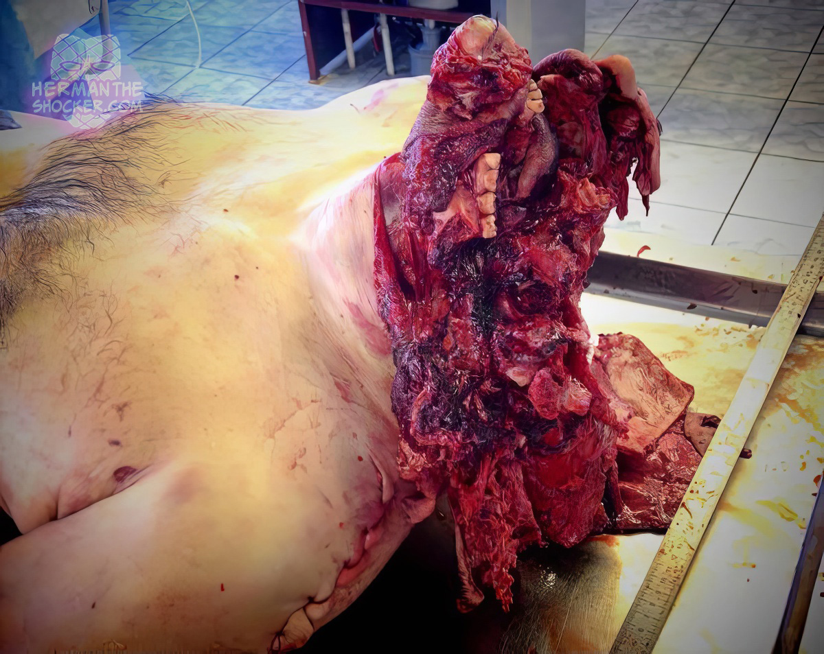 Massive head trauma from gunshot