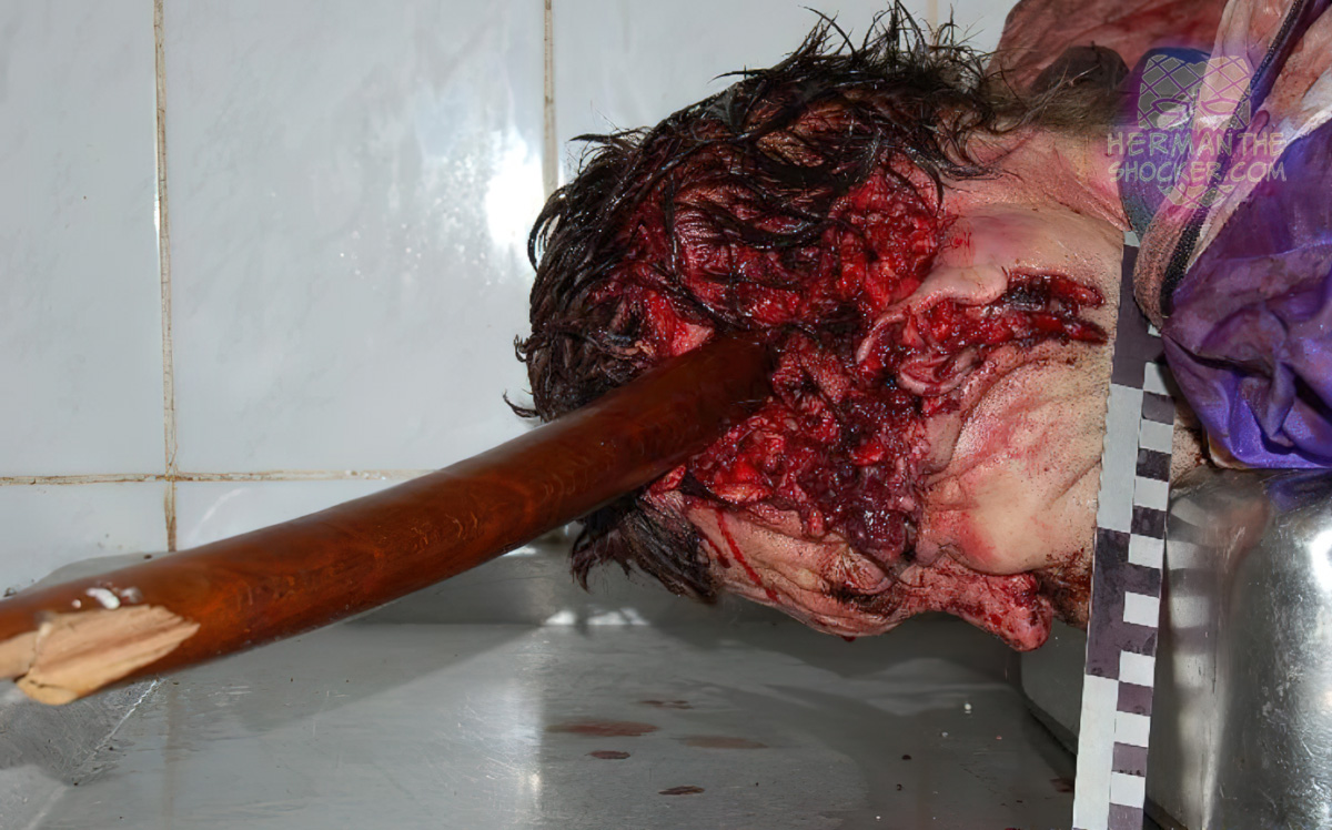 Drinking buddy kills friend with a chair leg