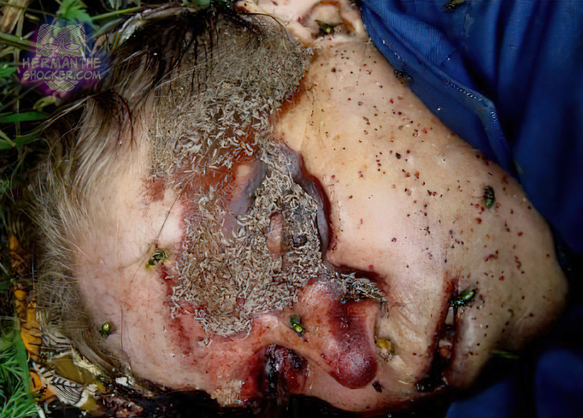 Maggots on face of deceased person