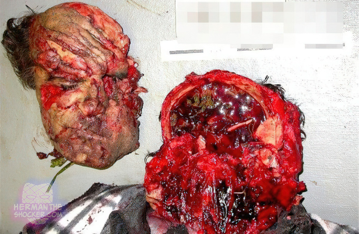 Face cut off in motorcycle accident