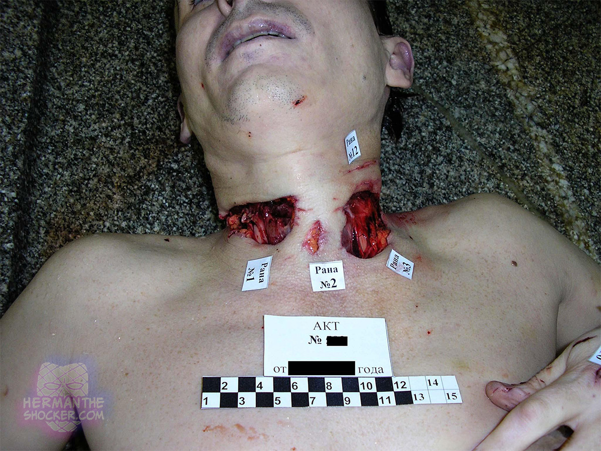 Suicide with a knife