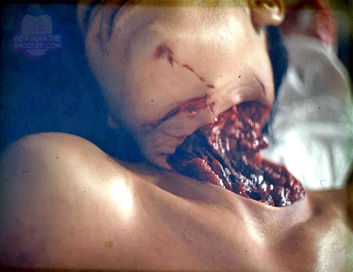 Near decapitation