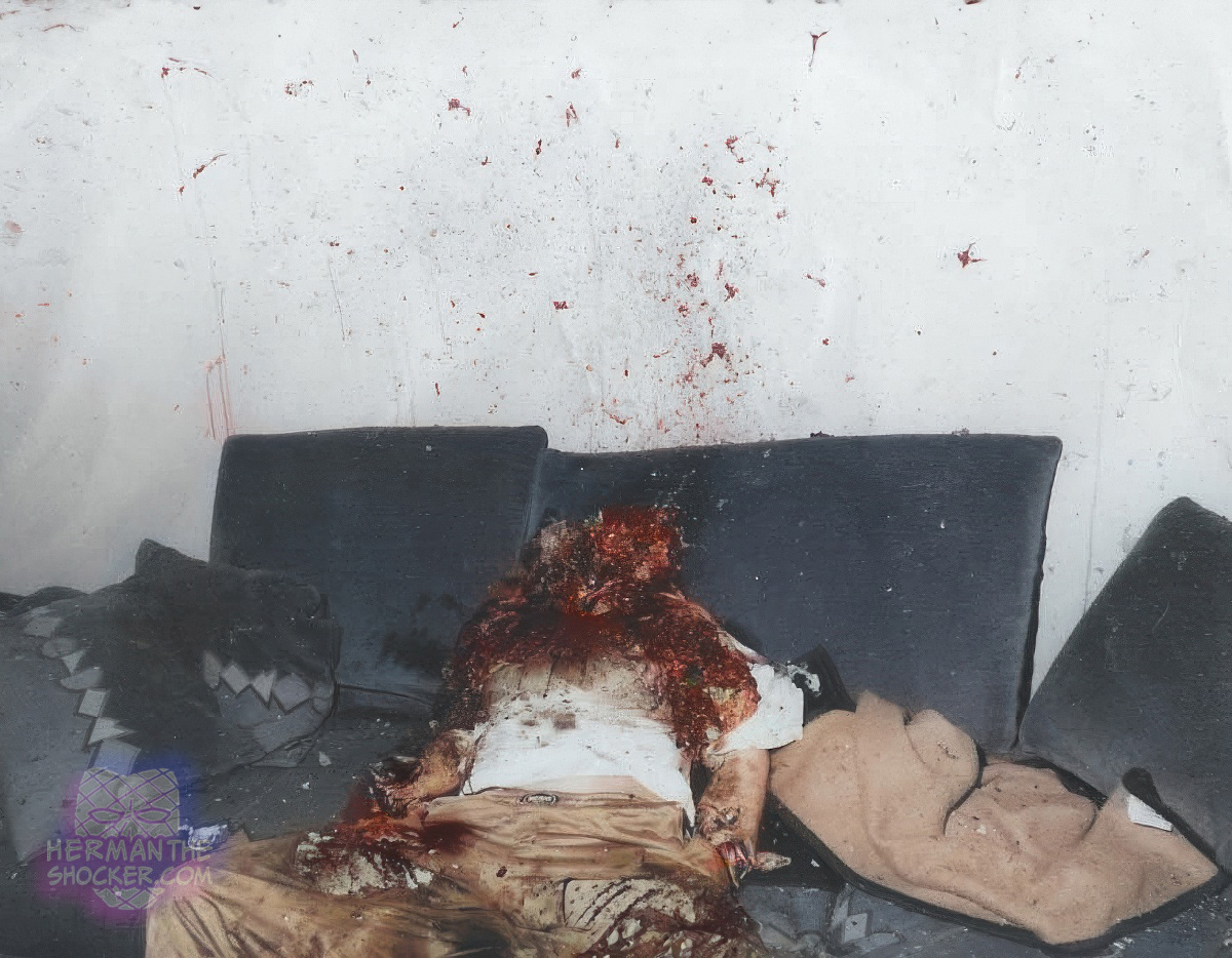 Suicide by holding a grenade close to mouth